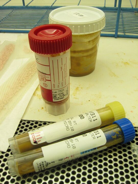 tests to detect parasites